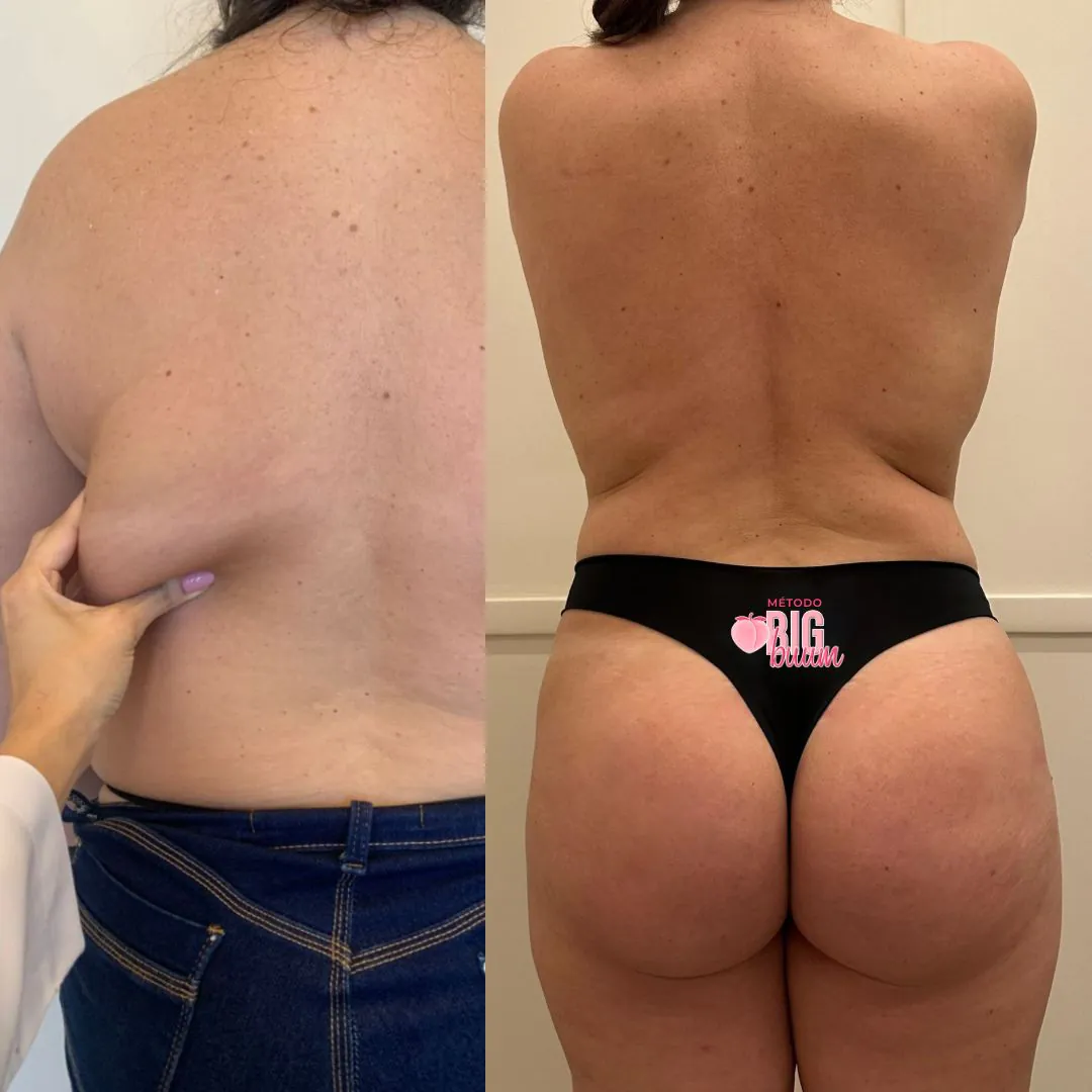 Antes e depois 1