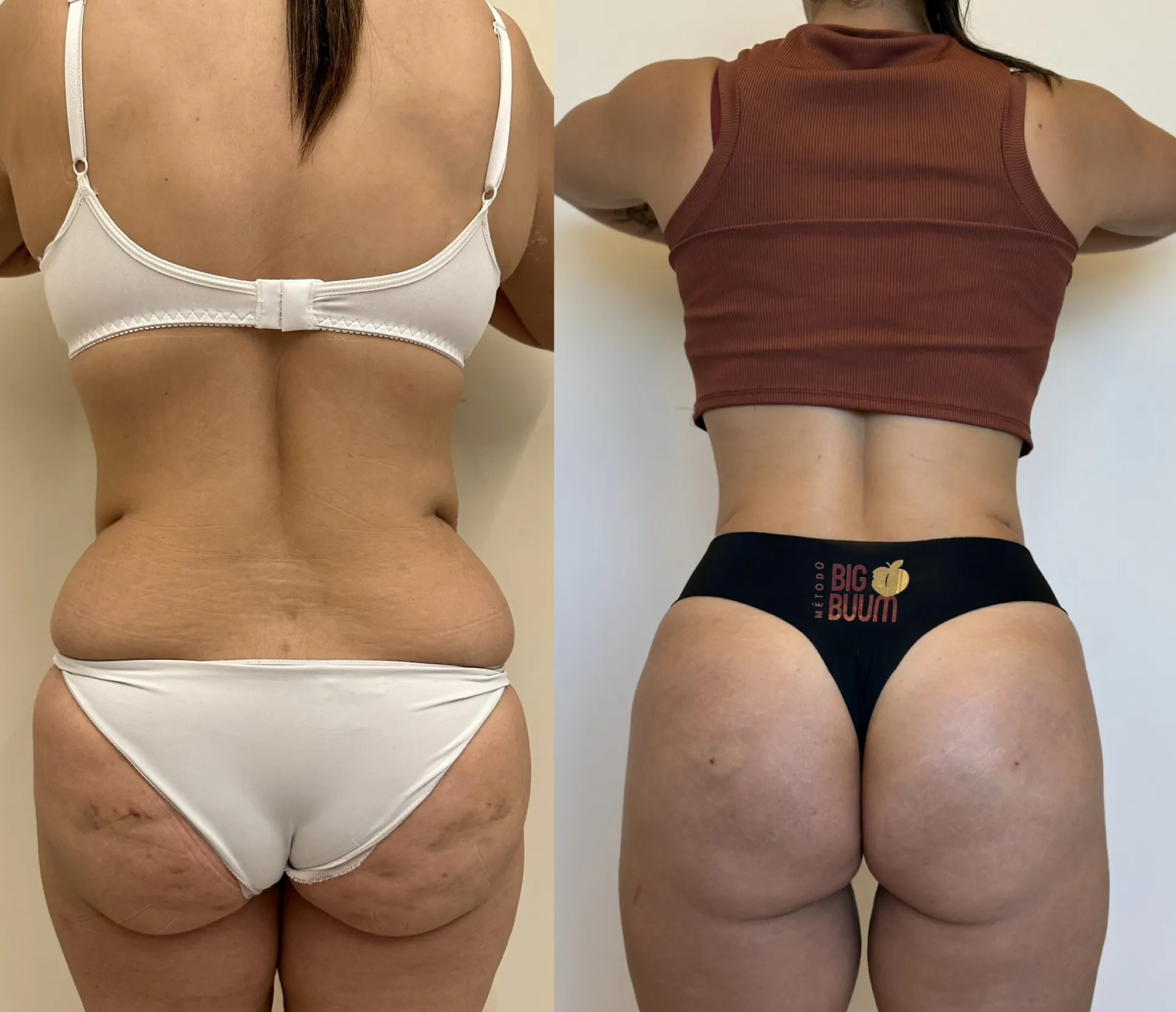 Antes e depois 2