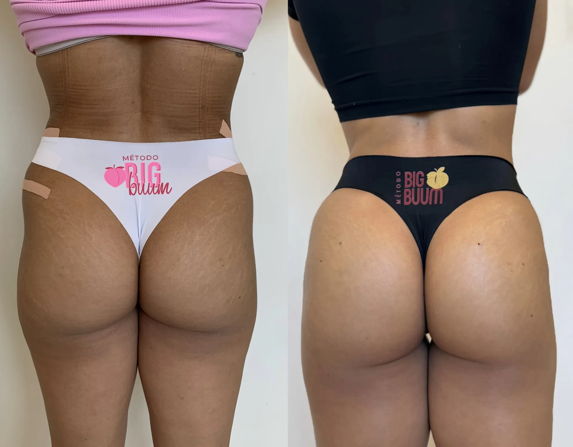 Antes e depois 4